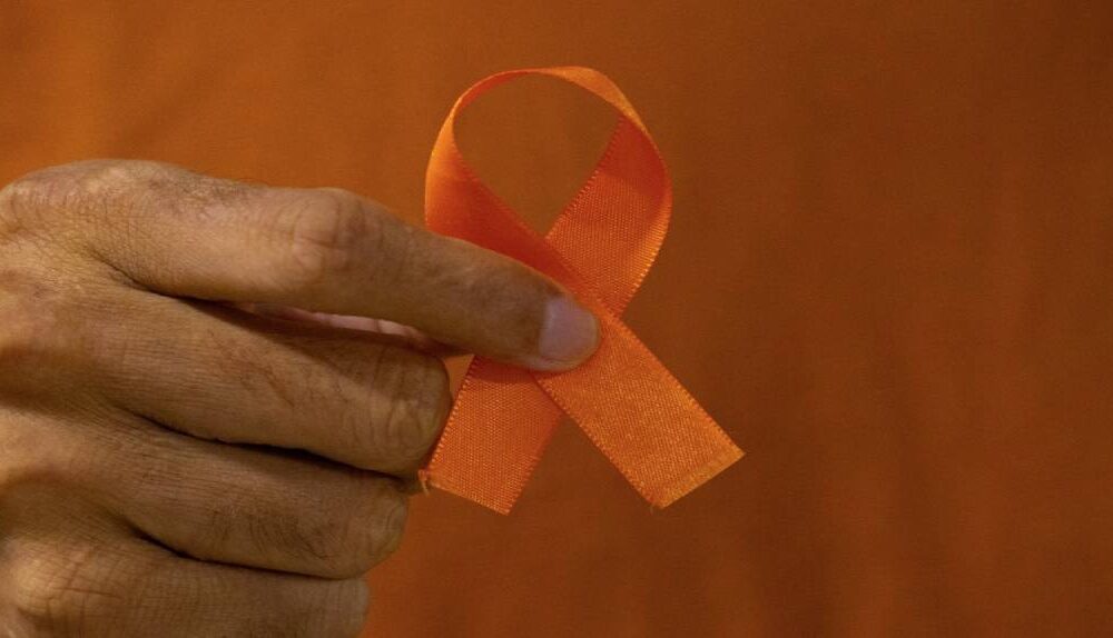 dezembro-laranja-assembleia-legislativa-garante-suporte-na-prevencao-ao-cancer-de-pele-em-rr