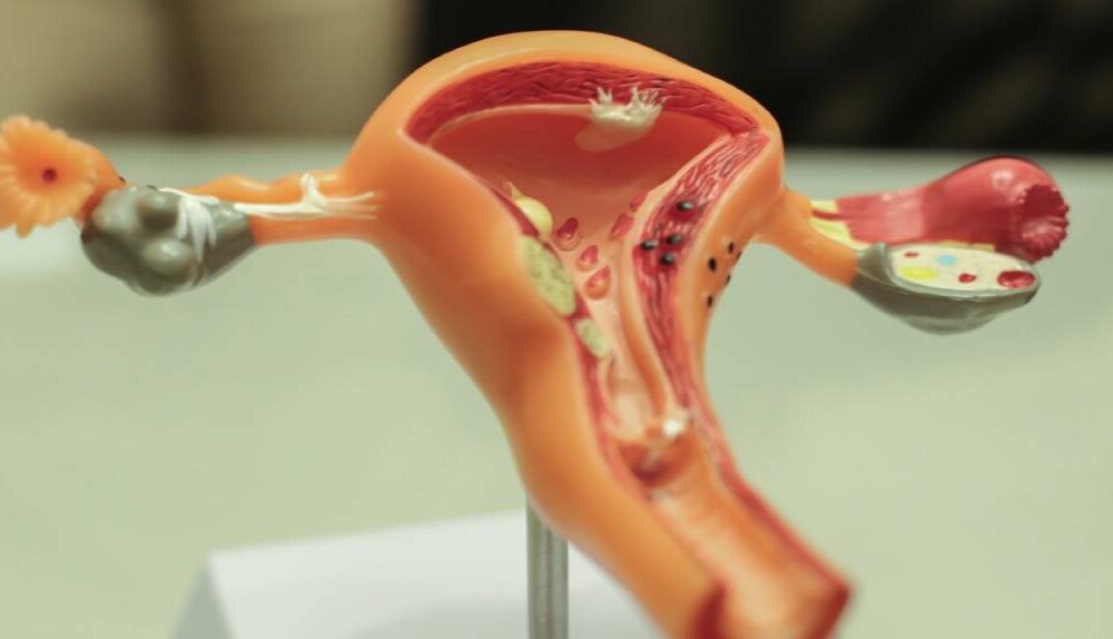 prevencao-e-autocuidado-dor-nao-e-normal:-marco-reforca-alerta-para-a-saude-da-mulher