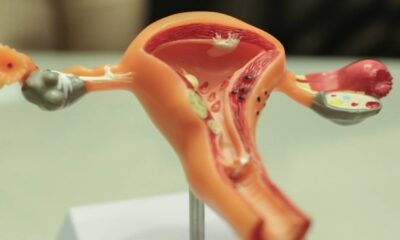 prevencao-e-autocuidado-dor-nao-e-normal:-marco-reforca-alerta-para-a-saude-da-mulher