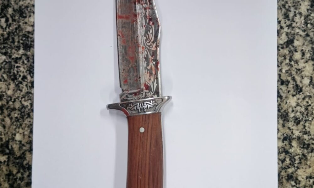 tatuador-e-esfaqueado-no-rosto-com-o-proprio-punhal-durante-briga-em-bar