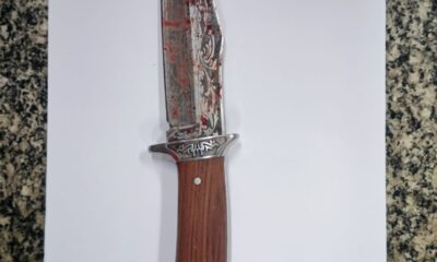 tatuador-e-esfaqueado-no-rosto-com-o-proprio-punhal-durante-briga-em-bar